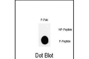 Dot blot analysis of Phospho-JUN- Pab (Cat. (C-JUN antibody  (pThr243))