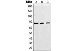 Western blot analysis of MTHFR expression in HEK293 (A), Jurkat (B), A549 (C) whole cell lysates.
