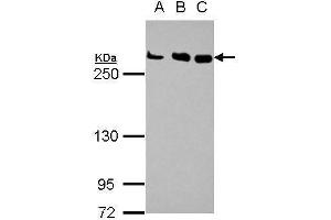 WB Image Sample (30 ug of whole cell lysate) A: Jurkat B: Raji C: K562 5% SDS PAGE antibody diluted at 1:1000 (CHD4 antibody  (N-Term))