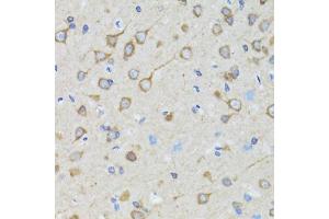 Immunohistochemistry of paraffin-embedded rat brain using TOLLIP antibody. (TOLLIP antibody)