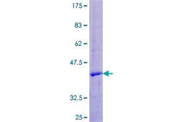 Urotensin 2 Protein (UTS2) (AA 1-124) (GST tag)