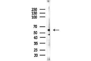 anti-G Protein-Coupled Receptor Kinase 7 (GRK7) (Internal Region) antibody
