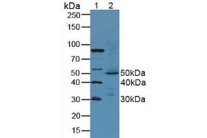 Figure. (Intrinsic Factor antibody  (AA 196-414))