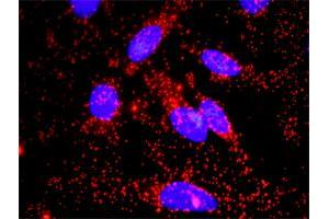 Proximity Ligation Analysis of protein-protein interactions between FAS and CTNNB1. (FAS antibody  (AA 1-335))