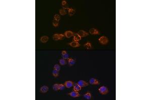 Immunofluorescence (IF) image for anti-Interferon Regulatory Factor 6 (IRF6) antibody (ABIN1680921)
