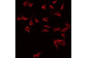 ABIN6275031 staining HeLa by IF/ICC. (C1QL2 antibody  (C-Term))