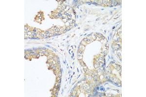 Immunohistochemistry of paraffin-embedded human prostate using CBL antibody at dilution of 1:200 (40x lens).