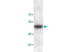 Western blot analysis of human skin lysate with ADAMTS2 polyclonal antibody  at 1 : 100 dilution. (Adamts2 antibody  (C-Term))