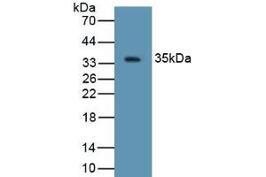 Detection of Recombinant DEFb2, Rat using Polyclonal Antibody to Defensin Beta 2 (DEFb2) (beta 2 Defensin antibody  (AA 23-63))