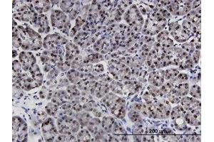 Image no. 1 for anti-LIM Domains Containing 1 (LIMD1) (AA 577-675) antibody (ABIN599481) (LIMD1 antibody  (AA 577-675))