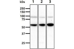 The cell lysates (40ug) were resolved by SDS-PAGE, transferred to PVDF membrane and probed with anti-human HSPA13 antibody (1:1000).