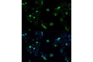 Immunofluorescence (IF) image for anti-ATP-Binding Cassette, Sub-Family C (CFTR/MRP), Member 4 (ABCC4) (AA 495-705) antibody (ABIN3023193)
