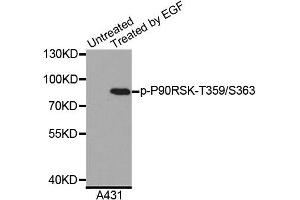 Western blot analysis of extracts of A431 cells, using Phospho-P90RSK-T359/S363 antibody (ABIN5996240). (RPS6KA3 antibody  (pSer363, pThr359))
