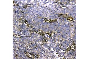 IHC analysis of MYBPC3 using anti-MYBPC3 antibody . (MYBPC3 antibody  (AA 1070-1123))