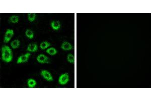 Peptide - +Immunohistochemistry analysis of paraffin-embedded human lung carcinoma tissue using ATP5D antibody. (ATP5F1D antibody)