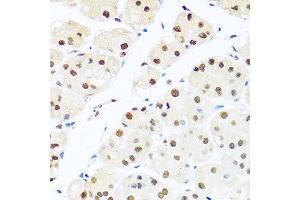 Immunohistochemistry of paraffin-embedded human stomach using RAB3IP antibody at dilution of 1:100 (x40 lens). (RAB3IP antibody)