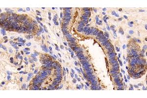 Immunohistochemistry (IHC) image for anti-Annexin A5 (ANXA5) (AA 1-321) antibody (ABIN7431455)