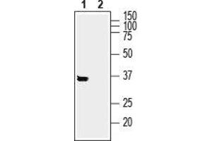 SYNDIG1 antibody  (Intracellular, N-Term)