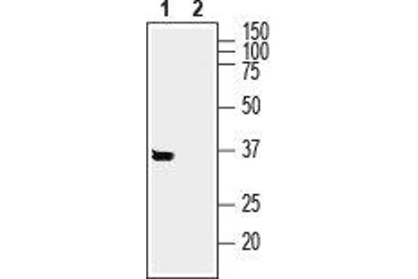 SYNDIG1 antibody  (Intracellular, N-Term)