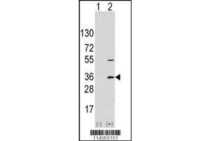 Western blot analysis of SSR1 using rabbit SSR1 Antibody using 293 cell lysates (2 ug/lane) either nontransfected (Lane 1) or transiently transfected with the SSR1 gene (Lane 2). (SSR1 antibody  (N-Term))