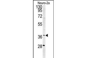 Western blot analysis of SNRNP40 Antibody (Center) (ABIN651465 and ABIN2840256) in Neuro-2a cell line lysates (35 μg/lane). (SNRNP40 antibody  (AA 122-149))