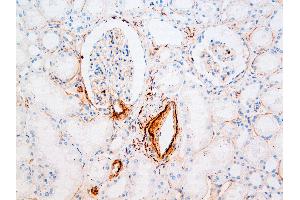 Immunohistochemistry (IHC) image for anti-Vitronectin (VTN) antibody (ABIN108419) (Vitronectin antibody)
