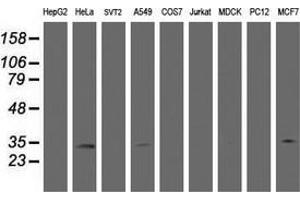 Western Blotting (WB) image for anti-Hydroxysteroid (17-Beta) Dehydrogenase 8 (HSD17B8) (AA 57-261) antibody (ABIN2715556) (HSD17B8 antibody  (AA 57-261))