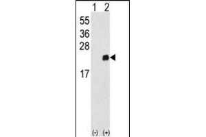 Western blot analysis of PRDX1 (arrow) using rabbit polyclonal PRDX1 Antibody (Center) (ABIN389467 and ABIN2839531). (Peroxiredoxin 1 antibody  (AA 88-116))