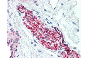 Anti-Nestin antibody IHC of human prostate, nerve. (Nestin antibody)