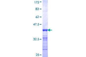 IKZF2 Protein (AA 298-397) (GST tag)