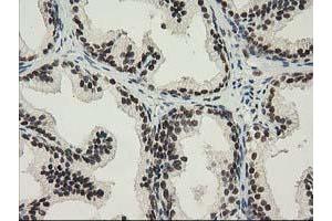 Image no. 6 for anti-Nonhomologous End-Joining Factor 1 (NHEJ1) antibody (ABIN1499729) (NHEJ1 antibody)