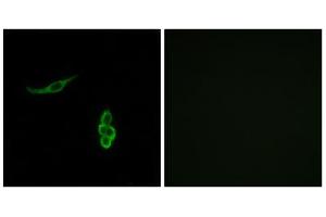 Immunofluorescence analysis of A549 cells, using SCNN1D antibody. (SCNN1D antibody  (Internal Region))