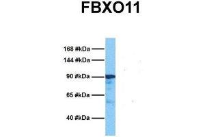 Host:  Rabbit  Target Name:  FBXO11  Sample Tissue:  Human Ovary Tumor  Antibody Dilution:  1. (FBXO11 antibody  (Middle Region))