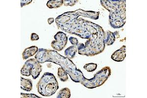 IHC analysis of ANGPTL4 using anti-ANGPTL4 antibody (ABIN5518734). (ANGPTL4 antibody  (C-Term))
