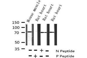 Western blot analysis of Phospho-p70 S6 Kinase (Ser411) expression in various lysates (RPS6KB1 antibody  (pSer411))