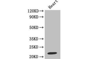 Western blotAll lanes: Metalloproteinase inhibitor 1 antibody at 2 μg/mlLane 1: Jurkat whole cell lysateLane 2: MCF-7 whole cell lysateSecondaryGoat polyclonal to rabbit at 1/10000 dilutionPredicted band size: 23 kDaObserved band size: 23 kDa.
