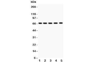 Western blot testing of HNF1A antibody and Lane 1:  rat liver;  2: (r) kidney;  3: (r) RH35;  4: human HeLa;  5: (h) HEPG2.