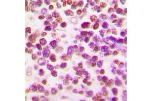 Immunohistochemical analysis of OCT2 staining in human tonsil formalin fixed paraffin embedded tissue section. (Oct-2 antibody  (N-Term))