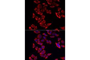 Immunofluorescence analysis of MCF-7 cells using RPL9 antibody. (RPL9 antibody  (AA 1-192))