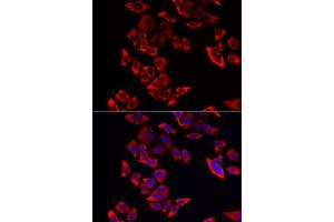 Immunofluorescence analysis of MCF-7 cells using RPL9 antibody. (RPL9 antibody  (AA 1-192))