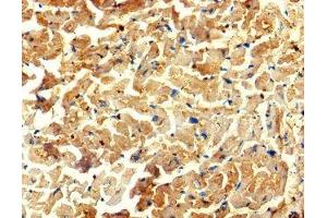 Immunohistochemistry of paraffin-embedded human heart tissue using ABIN7175734 at dilution of 1:100 (WDR27 antibody  (AA 501-730))