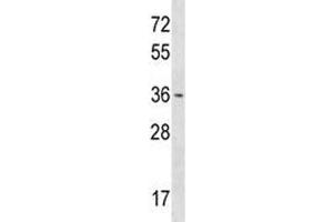 OTX1 antibody western blot analysis in T47D lysate. (OTX1 antibody  (AA 87-116))