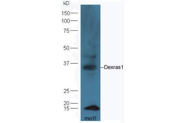RASD1 antibody  (AA 21-120)