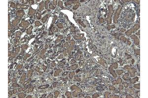 Immunohistochemistry (IHC) image for anti-Catalase (CAT) (Internal Region) antibody (ABIN185651)