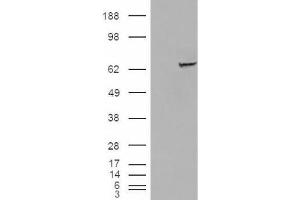 Western Blotting (WB) image for anti-Insulin-Like Growth Factor 2 mRNA Binding Protein 2 (IGF2BP2) (C-Term) antibody (ABIN2466526) (IGF2BP2 antibody  (C-Term))