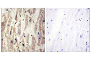 Immunohistochemistry analysis of paraffin-embedded human heart tissue using LAMA4 antibody. (LAMa4 antibody  (Internal Region))