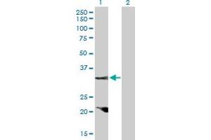 Western Blot analysis of CCND2 expression in transfected 293T cell line by CCND2 MaxPab polyclonal antibody. (Cyclin D2 antibody  (AA 1-289))