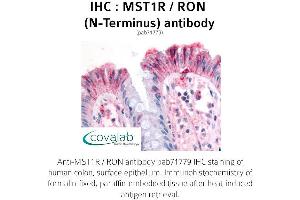Image no. 1 for anti-Macrophage Stimulating 1 Receptor (C-Met-Related tyrosine Kinase) (MST1R) (N-Term) antibody (ABIN1737098) (MST1R antibody  (N-Term))
