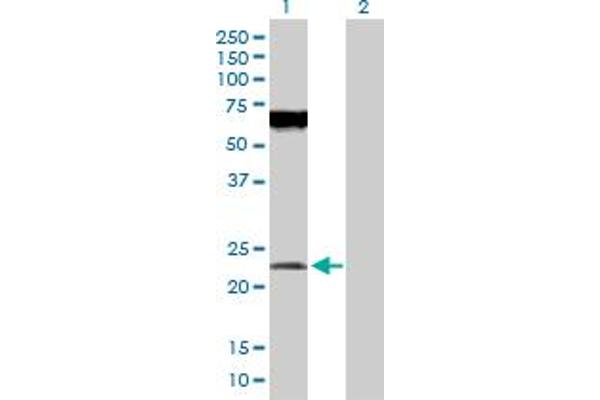 POFUT1 anticorps  (AA 1-194)