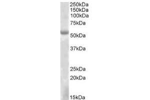 Image no. 1 for anti-Eyes Absent Homolog 1 (EYA1) (Internal Region) antibody (ABIN487975)